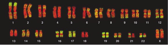 Локализация мобильных элементов ALU в ядрах лимфоцитов. Зеленым цветом выделены ALU-последовательности; красным — участки хромосом, закрашенные для контраста флуорисцентным красителем
